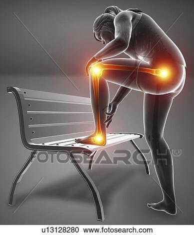 Woman with leg pain, computer illustration. View Large Photo Image Stock Image - Woman with leg pain, computer illustration.. Fotosearch