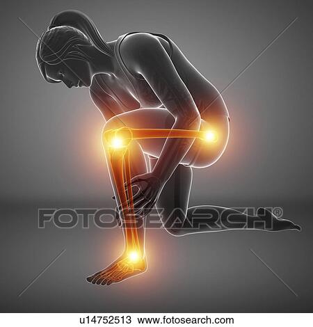 Stock Image - Woman with leg pain, computer illustration.. Fotosearch