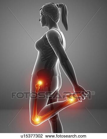 Stock Image - Woman with leg pain, computer illustration.. Fotosearch