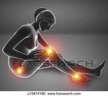 Stock Image - Woman with leg pain, computer illustration.. Fotosearch