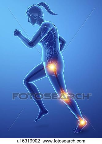 Woman with leg pain, computer illustration. View Large Photo Image Stock Image - Woman with leg pain, computer illustration.. Fotosearch