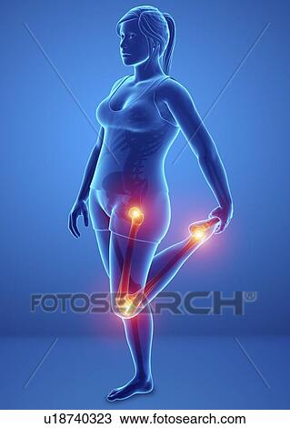 Woman with leg pain, computer illustration. View Large Photo Image Stock Image - Woman with leg pain, computer illustration.. Fotosearch