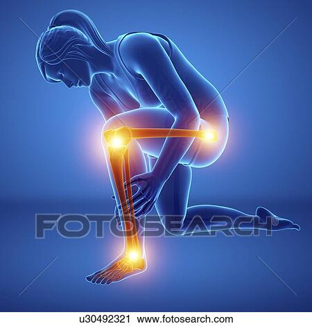 Stock Image - Woman with leg pain, computer illustration.. Fotosearch