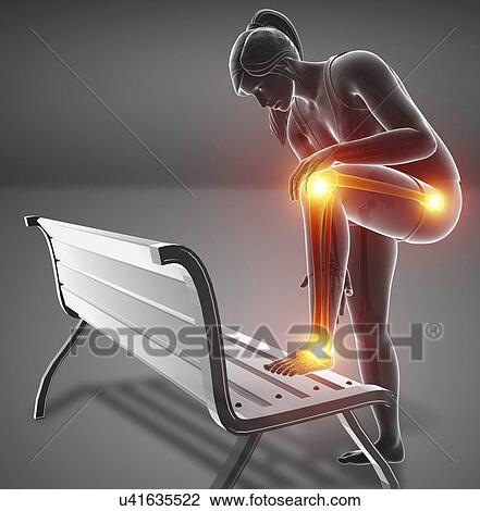 Stock Image - Woman with leg pain, computer illustration.. Fotosearch