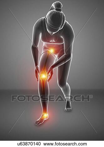 Stock Image - Woman with leg pain, computer illustration.. Fotosearch