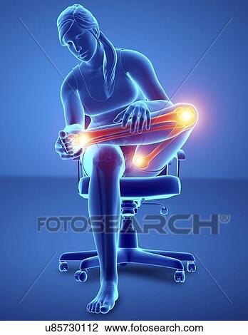 Woman with leg pain, computer illustration. View Large Photo Image Stock Image - Woman with leg pain, computer illustration.. Fotosearch