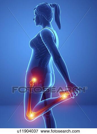Stock Photo - Woman with leg pain, computer illustration.. Fotosearch