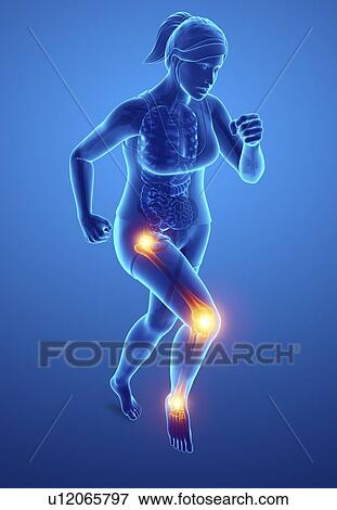 Stock Photo - Woman with leg pain, computer illustration.. Fotosearch