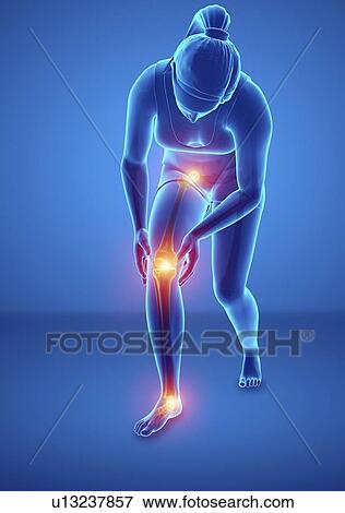 Woman with leg pain, computer illustration. View Large Photo Image Stock Photo - Woman with leg pain, computer illustration.. Fotosearch