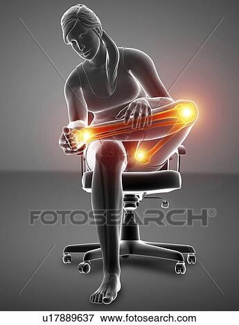 Stock Photo - Woman with leg pain, computer illustration.. Fotosearch