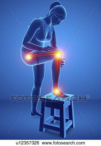 Woman with leg pain, computer illustration. View Large Photo Image Stock Photograph - Woman with leg pain, computer illustration.. Fotosearch
