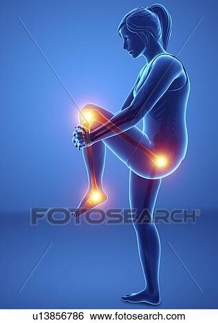 Stock Photograph - Woman with leg pain, computer illustration.. Fotosearch