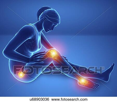 Stock Photograph - Woman with leg pain, computer illustration.. Fotosearch