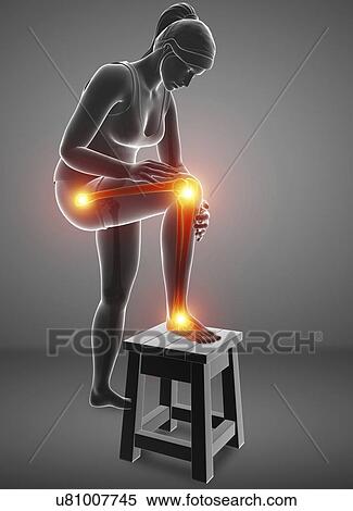 Stock Photography - Woman with leg pain, computer illustration.. Fotosearch
