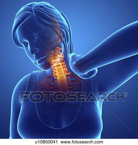 Woman with neck pain, computer illustration. View Large Photo Image Stock Image - Woman with neck pain, computer illustration.. Fotosearch