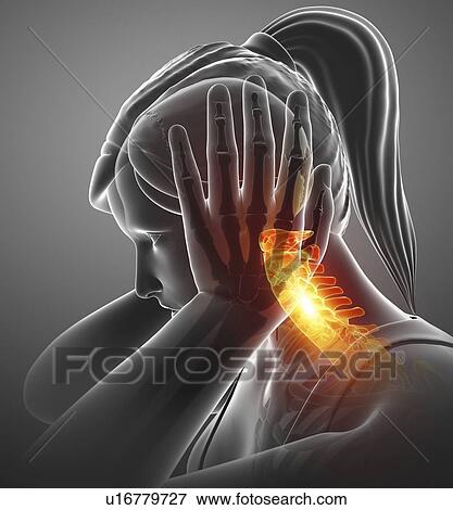 Woman with neck pain, computer illustration. View Large Photo Image Stock Photo - Woman with neck pain, computer illustration.. Fotosearch
