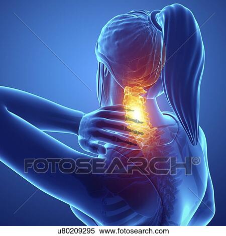 Stock Photography - Woman with neck pain, computer illustration.. Fotosearch