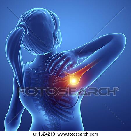 Woman with shoulder pain, computer illustration. View Large Photo Image Stock Image - Woman with shoulder pain, computer illustration.. Fotosearch