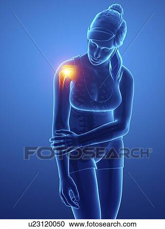 Stock Image - Woman with shoulder pain, computer illustration.. Fotosearch