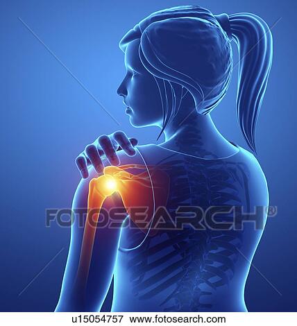 Woman with shoulder pain, computer illustration. View Large Photo Image Stock Photo - Woman with shoulder pain, computer illustration.. Fotosearch