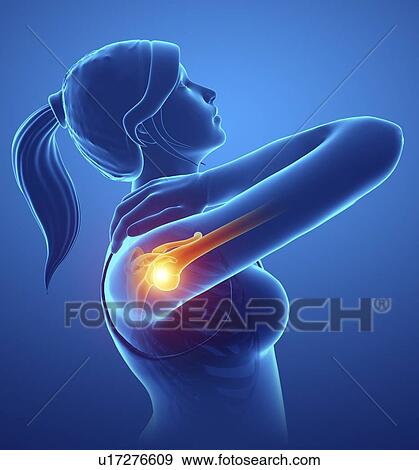Woman with shoulder pain, computer illustration. View Large Photo Image Stock Photo - Woman with shoulder pain, computer illustration.. Fotosearch