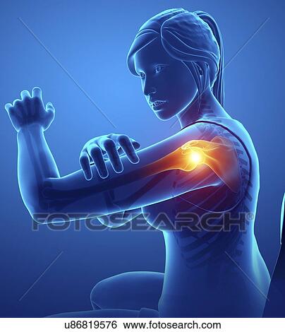 Woman with shoulder pain, computer illustration. View Large Photo Image Stock Photograph - Woman with shoulder pain, computer illustration.. Fotosearch