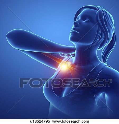 Stock Photography - Woman with shoulder pain, computer illustration.. Fotosearch