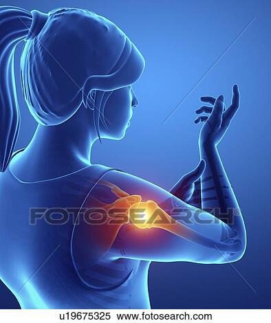 Stock Photography - Woman with shoulder pain, computer illustration.. Fotosearch