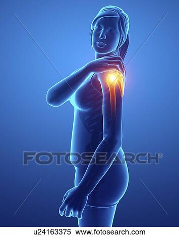 Woman with shoulder pain, computer illustration. View Large Photo Image Stock Photography - Woman with shoulder pain, computer illustration.. Fotosearch