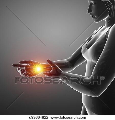 Stock Image - Woman with wrist pain, computer illustration.. Fotosearch