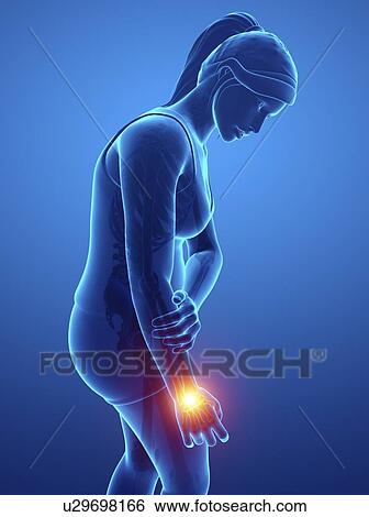 Woman with wrist pain, computer illustration. View Large Photo Image Stock Photograph - Woman with wrist pain, computer illustration.. Fotosearch