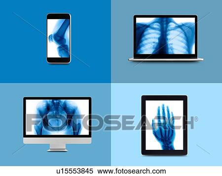 X-ray montage on digital device screens. View Large Photo Image Stock Photography - X-ray montage on digital device screens.. Fotosearch