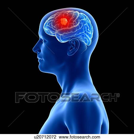 3d rendered illustration of a brain. View Large Photo Image Stock Image - 3d rendered illustration of a brain.. Fotosearch