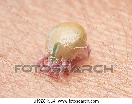 3d rendered illustration of a dust mite. View Large Photo Image Picture - 3d rendered illustration of a dust mite.. Fotosearch