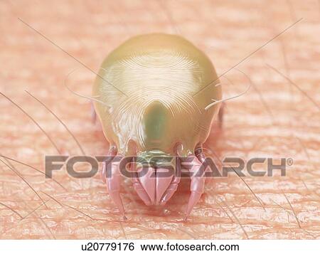 3d rendered illustration of a dust mite. View Large Photo Image Stock Photograph - 3d rendered illustration of a dust mite.. Fotosearch