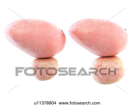 3d rendered illustration of a healthy and an enlarged prostate. View Large Photo Image Picture - 3d rendered illustration of a healthy and an enlarged prostate.. Fotosearch