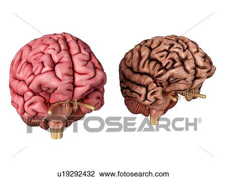 3d rendered illustration of a healthy and unhealthy brain. View Large Photo Image Stock Image - 3d rendered illustration of a healthy and unhealthy brain.. Fotosearch