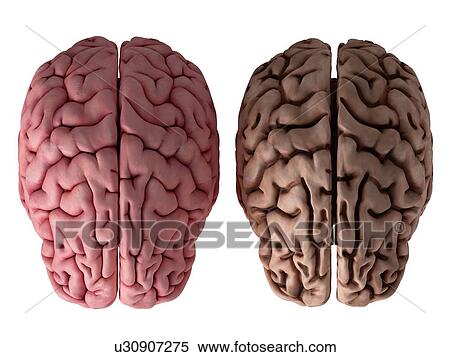 Stock Photography - 3d rendered illustration of a healthy and unhealthy brain.. Fotosearch