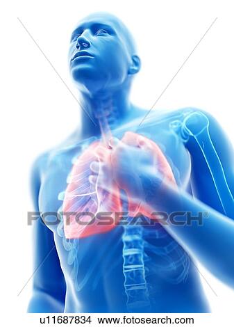 Picture - 3d rendered illustration of a man with an inflamed lung.. Fotosearch