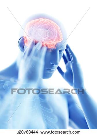 3d rendered illustration of a man with a headache. View Large Photo Image Picture - 3d rendered illustration of a man with a headache.. Fotosearch