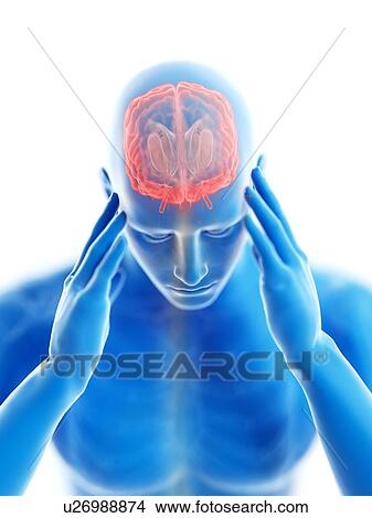 Picture - 3d rendered illustration of a man with a headache.. Fotosearch