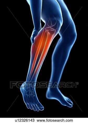 3d rendered illustration of a man with a painful calf. View Large Photo Image Stock Image - 3d rendered illustration of a man with a painful calf.. Fotosearch