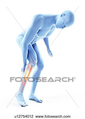 Stock Image - 3d rendered illustration of a man with a painful calf.. Fotosearch