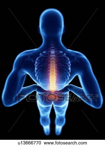 Stock Image - 3d rendered illustration of a man with backache.. Fotosearch