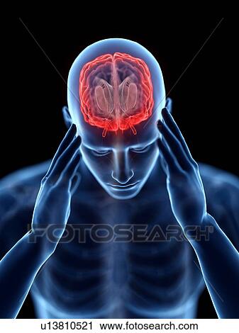 Stock Image - 3d rendered illustration of a man with a headache.. Fotosearch