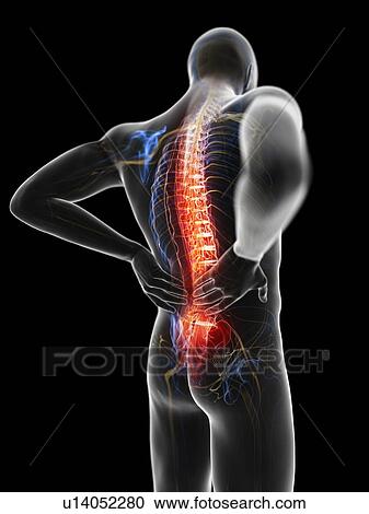 Stock Image - 3d rendered illustration of a man with backache.. Fotosearch