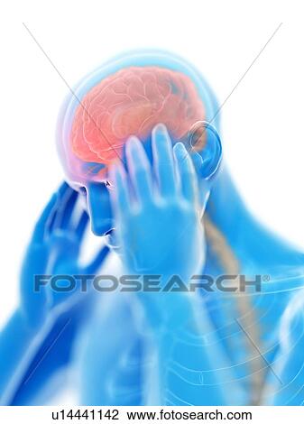 Stock Image - 3d rendered illustration of a man with a headache.. Fotosearch
