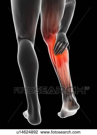 Stock Image - 3d rendered illustration of a man with a painful calf.. Fotosearch