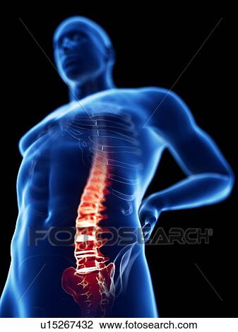 Stock Image - 3d rendered illustration of a man with backache.. Fotosearch