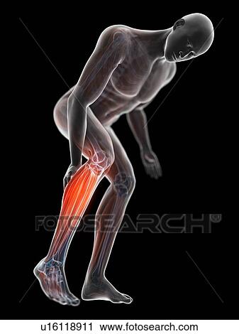 3d rendered illustration of a man with a painful calf. View Large Photo Image Stock Image - 3d rendered illustration of a man with a painful calf.. Fotosearch